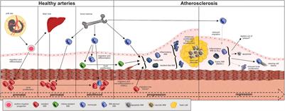 Macrophages in Atheromatous Plaque Developmental Stages